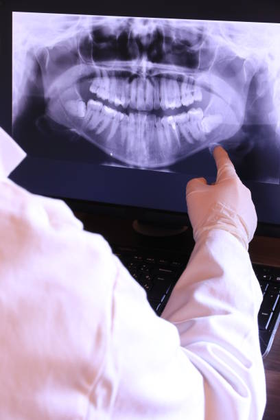 Best Emergency Treatment for Toothache in Amsterdam, NY